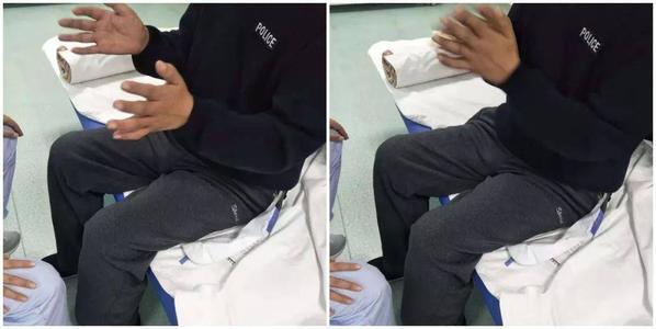 脑萎缩四步康复训练方法
