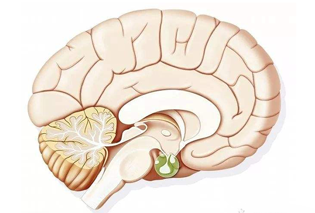 小脑萎缩形成的主要原因
