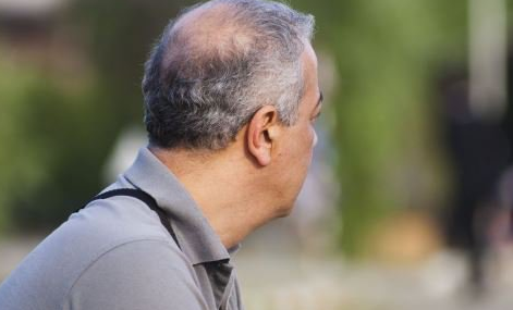 老年性脑萎缩的治疗方法